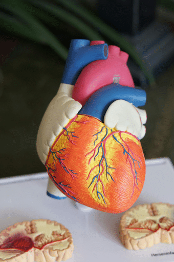 Donation Following Determination of Death by Circulatory Criteria (DCC)
